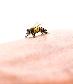Hướng dẫn cách xử lý khi bị ong đốt nhanh chóng và hiệu quả